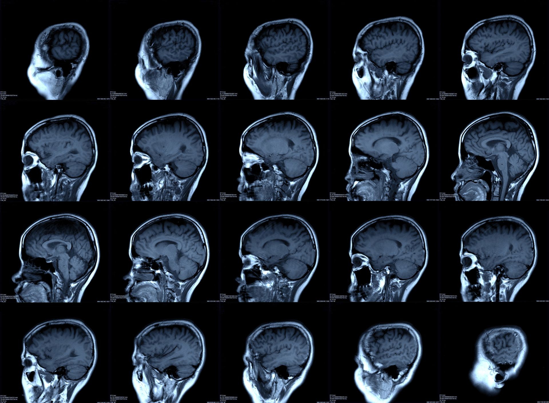 x-ray images brain or magnetic resonance image (mri scan) of patient.